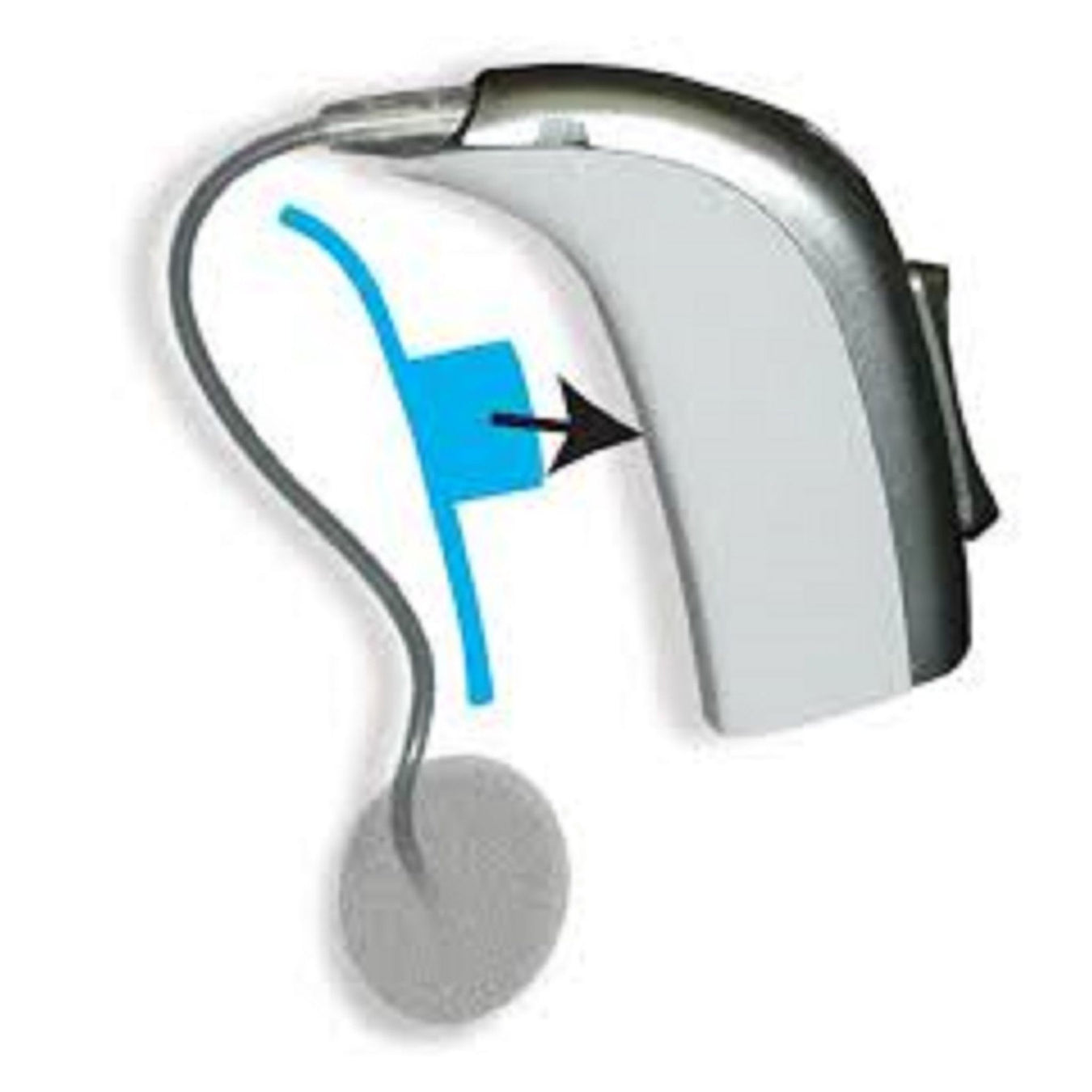 Ear Care & Hearing Aid Supplies > Hearing Aid Supplies > Adhesive Pads & Stickers